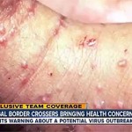Illegals Invasion, Spreading Disease Americans Just Won’t Do